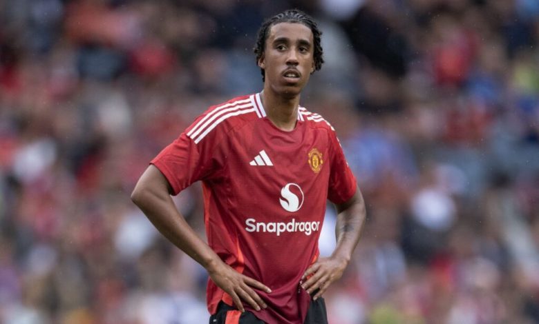 مانشستر يونايتد تعاقد مع يورو رغم مشاكله العضلية